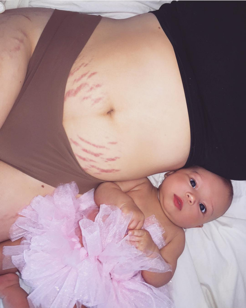 тело женщины сразу после родов фото