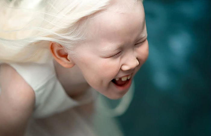 Нарияна альбинос из Якутии