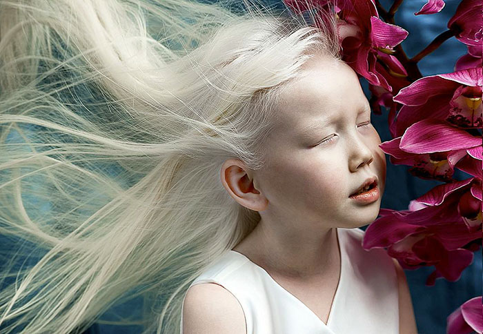 Нарияна альбинос из Якутии