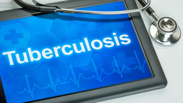 Не пропустити хворобу: тест для перевірки на туберкульоз можна пройти онлайн