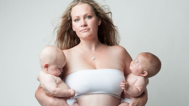 Вынужденная пластика: когда и зачем после родов идти к хирургу - мнение эксперта