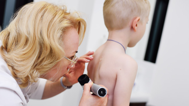 рак шкіри, родимки у дитини