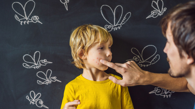 укуси комарів