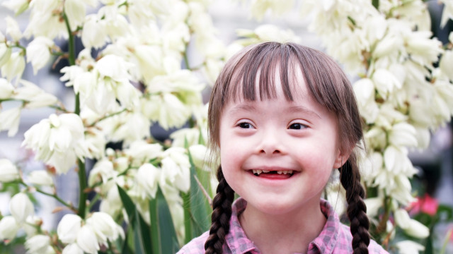 синдром дауна