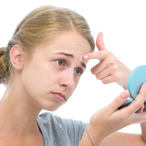 акне у підлітка