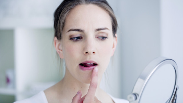 жінка з герпесом на губах