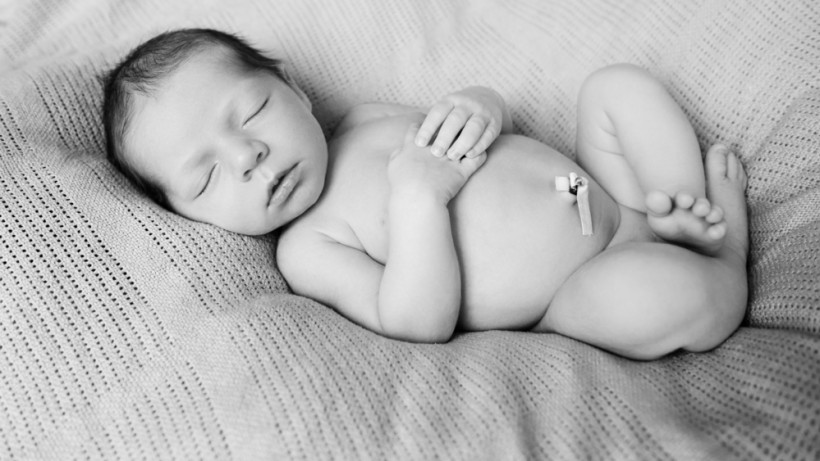Спящий младенец с прищепкой на пупке - лечение фунгуса пупка