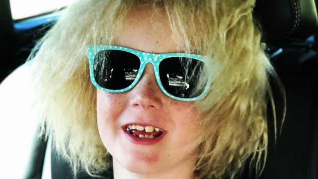 девочка, которая живет с редким генетическим заболеванием