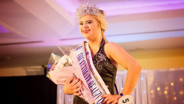 19-річна Кейт Грант із синдромом Дауна