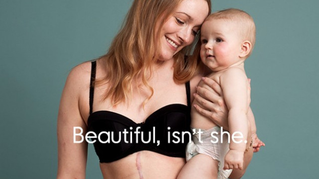 тело после родов