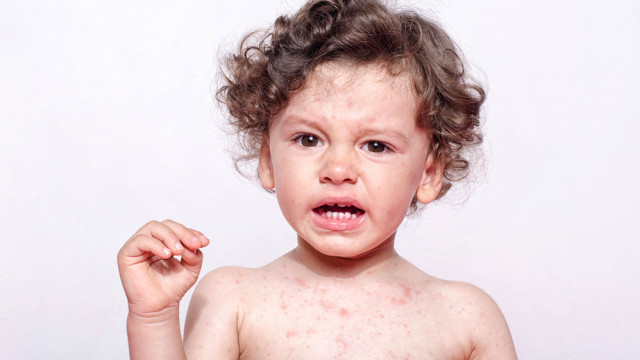 вакцина кпк мифы