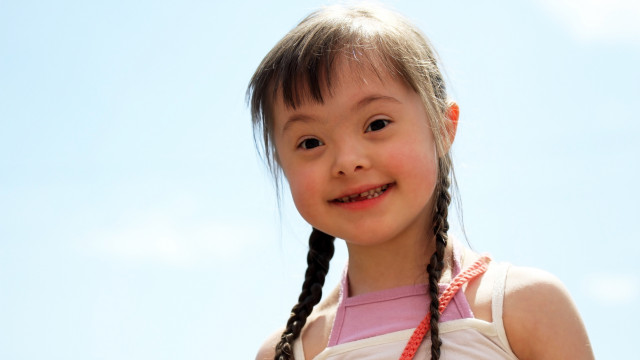 синдром дауна девочка