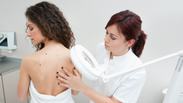 Проверь свою родинку: что важно знать каждому о родинках и родимых пятнах